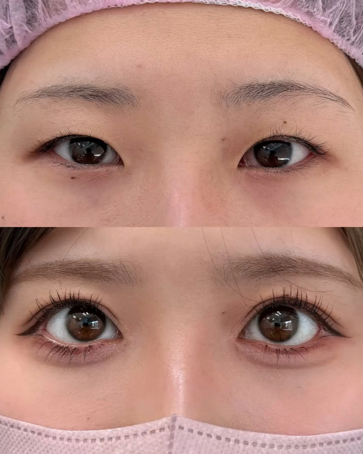 劇的に変える目フル