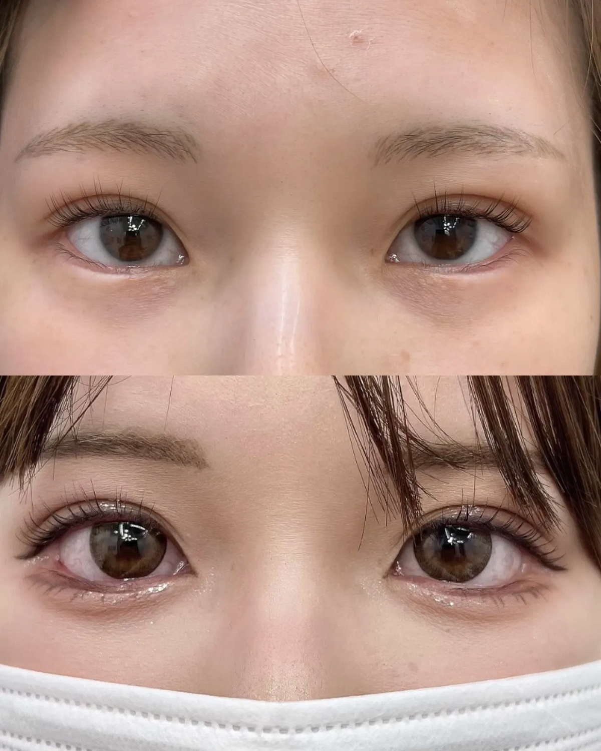 外側白目を拡大して優しい印象に