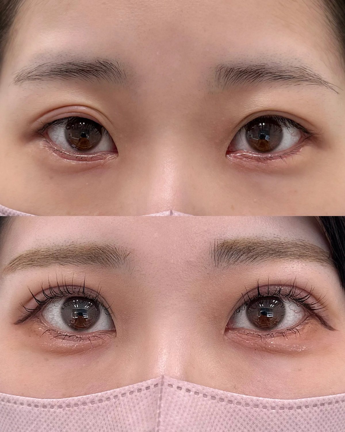 アイプチで皮膚が伸びまつ毛のキワが見えない・・・