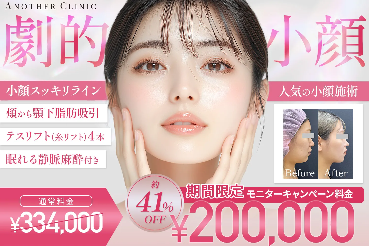 小顔劇的　人気の小顔施術　小顔スッキリライン