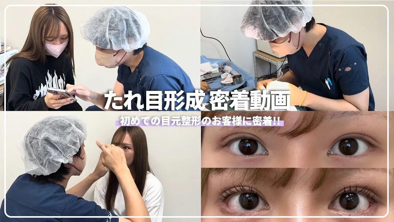 初めての目元切開！ずっと目元整形かをやりたかったお客様に密着！