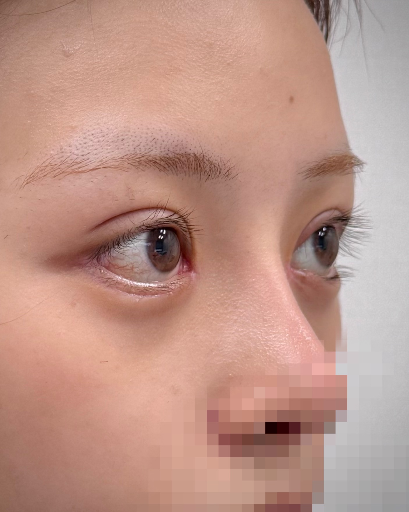 目を大きくして出目感を出す